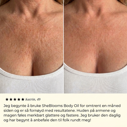 SheBloom® kiinteyttävä vartaloöljy