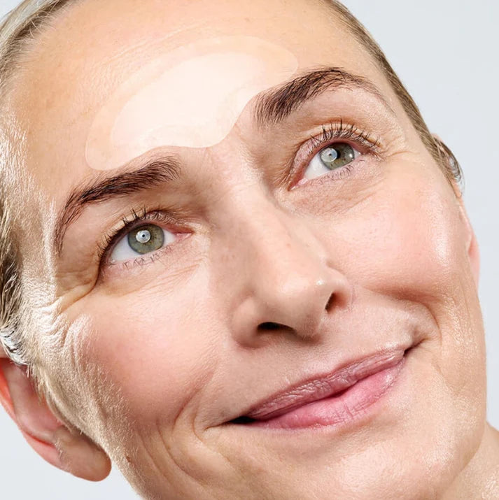 Forehead Microneedle Patches